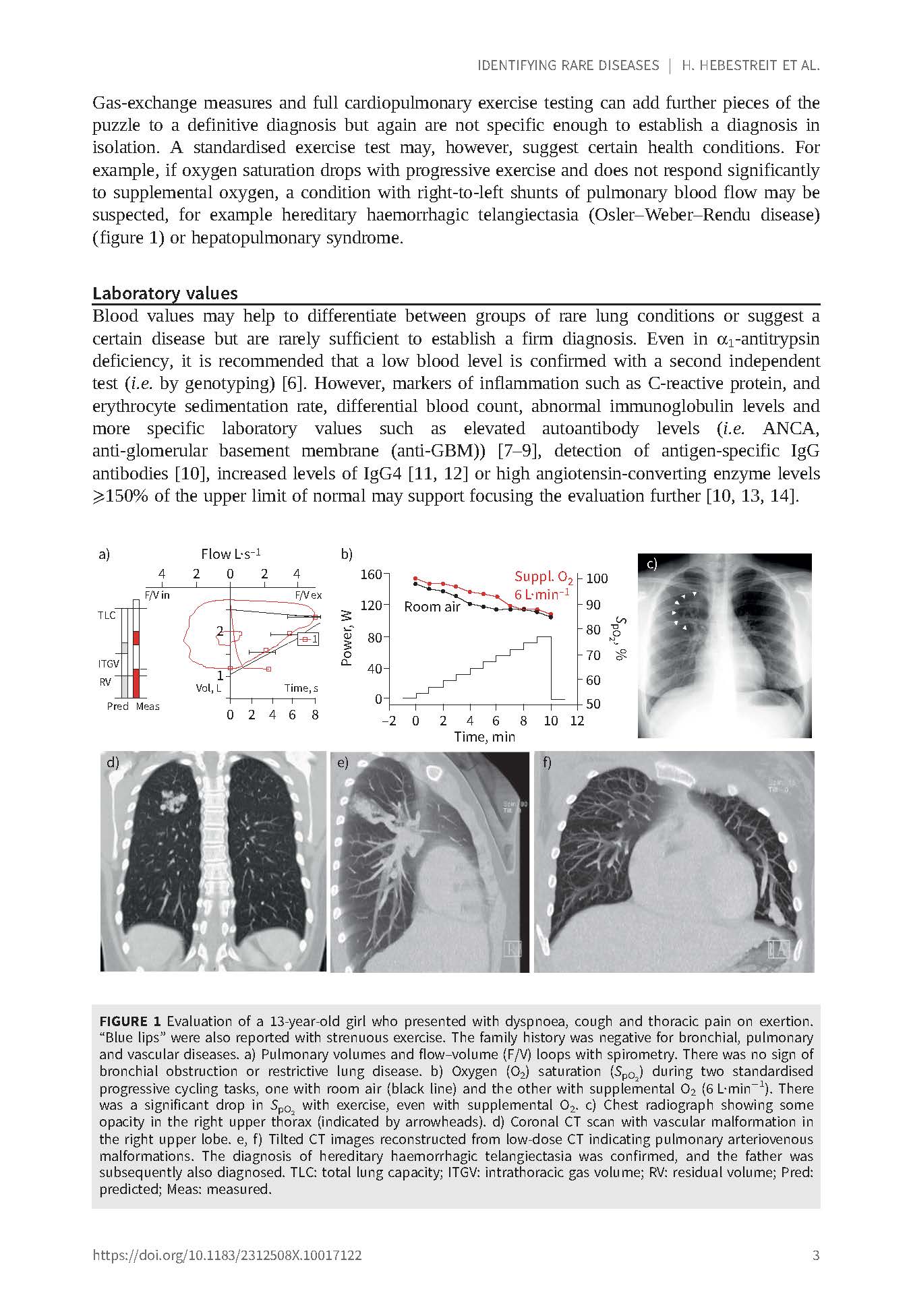 Rare Diseases of the Respiratory System