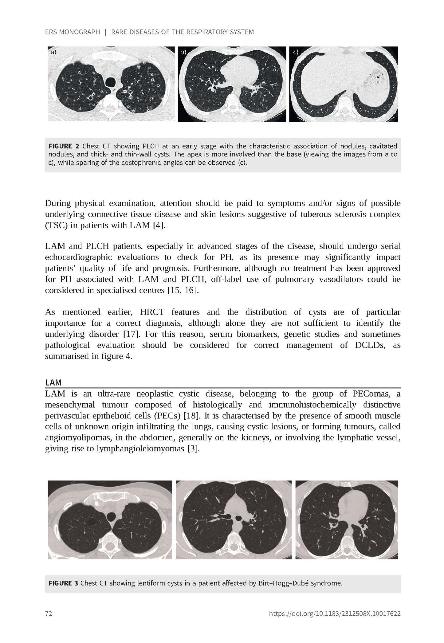 Rare Diseases of the Respiratory System