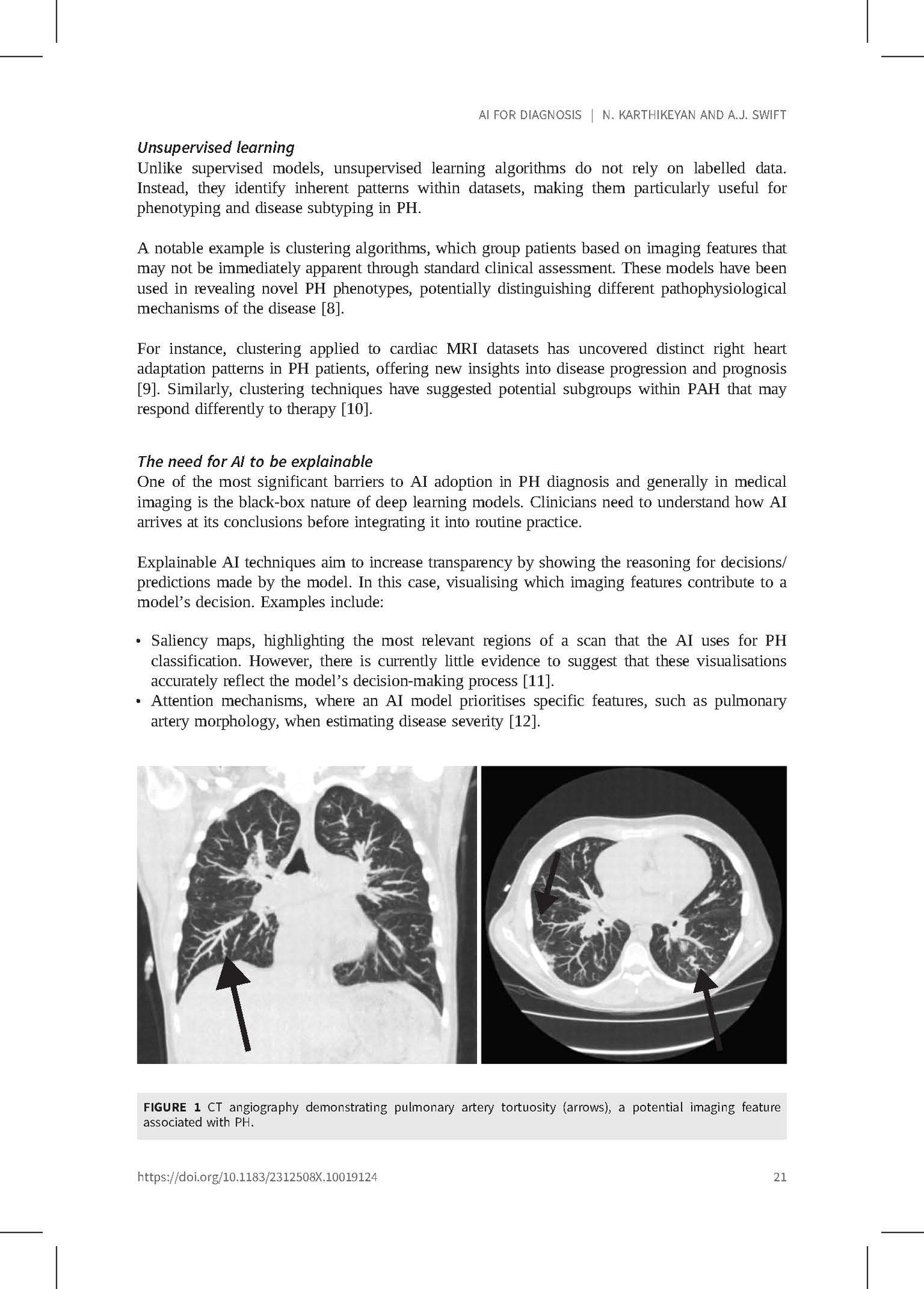 Pulmonary Hypertension