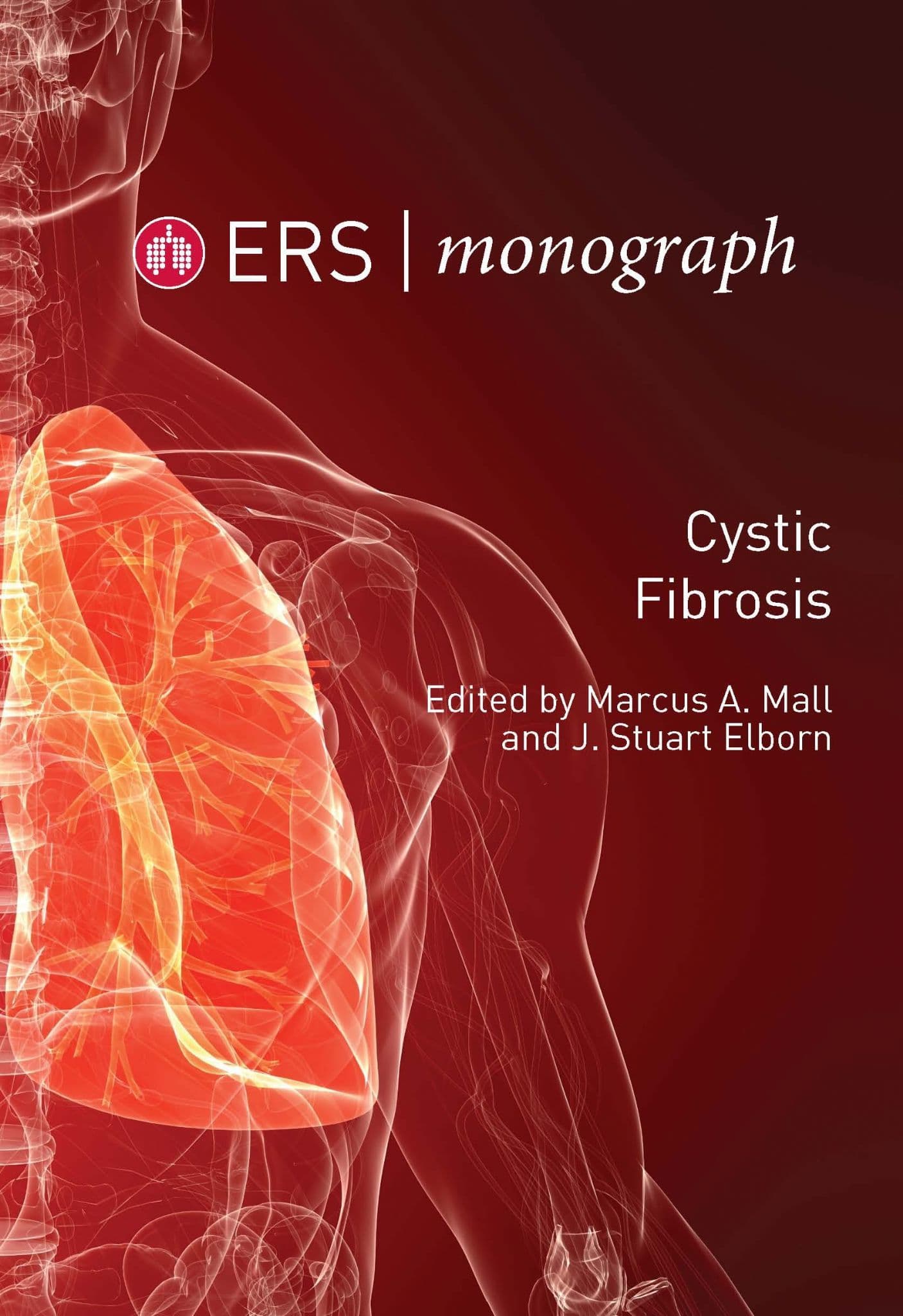 Cystic Fibrosis