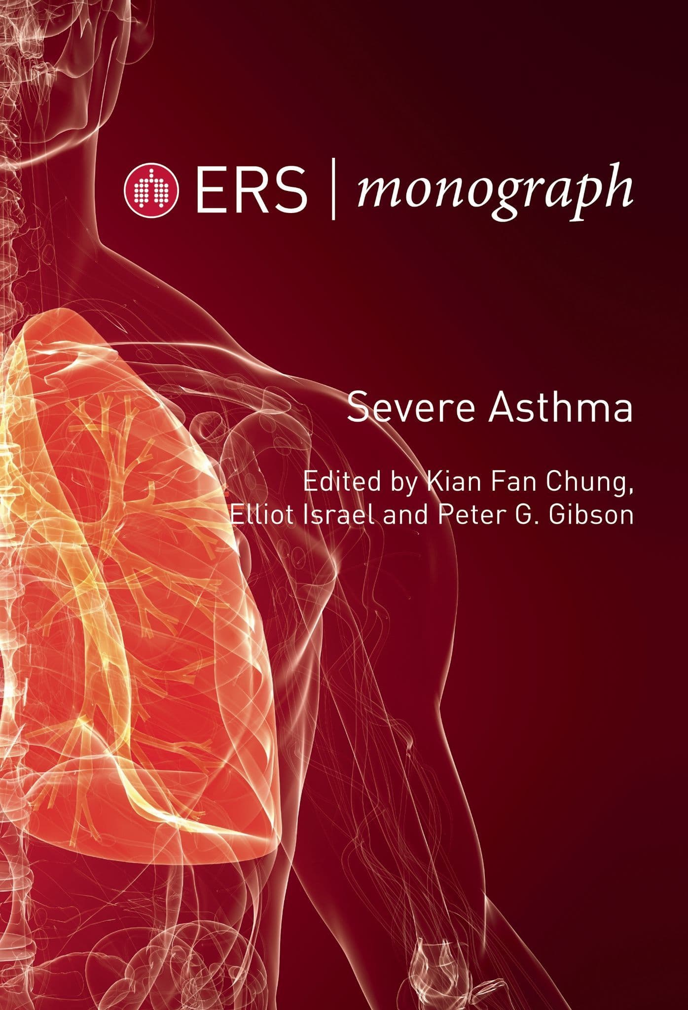 Severe Asthma