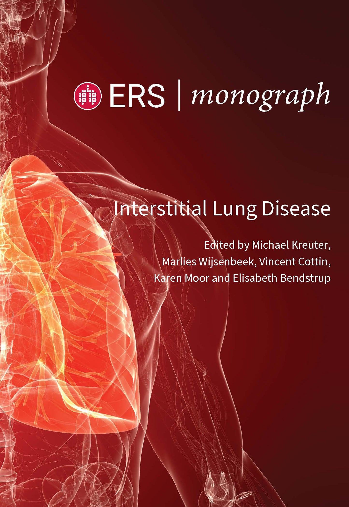 Interstitial Lung Disease