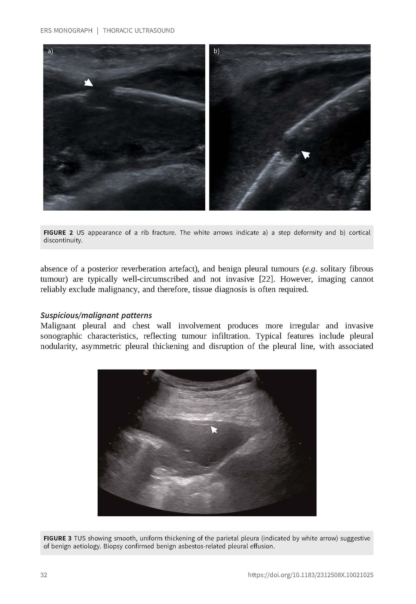 Thoracic Ultrasound