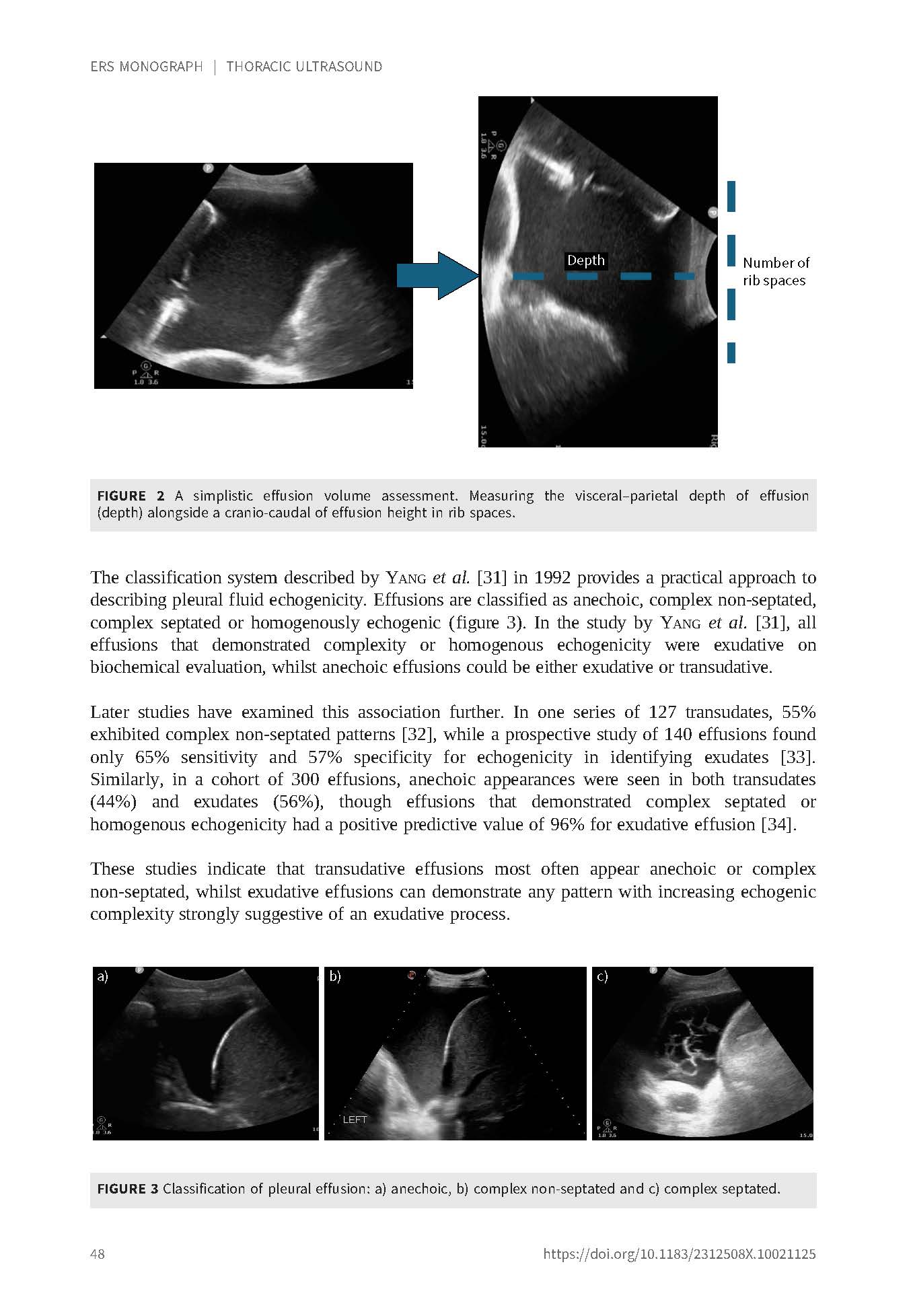 Thoracic Ultrasound