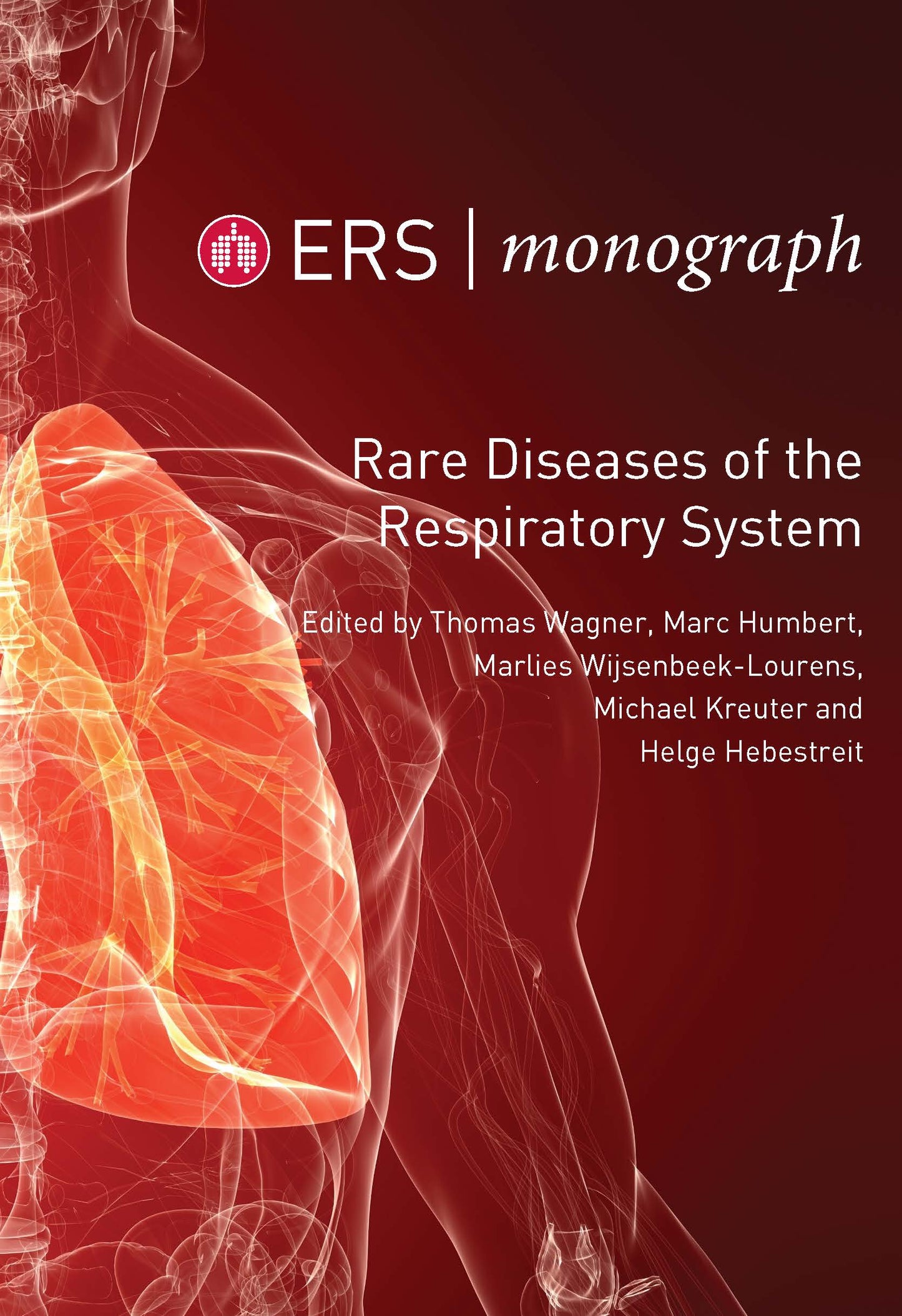 Front cover of ERS Monograph 100: Rare Diseases of the Respiratory System
