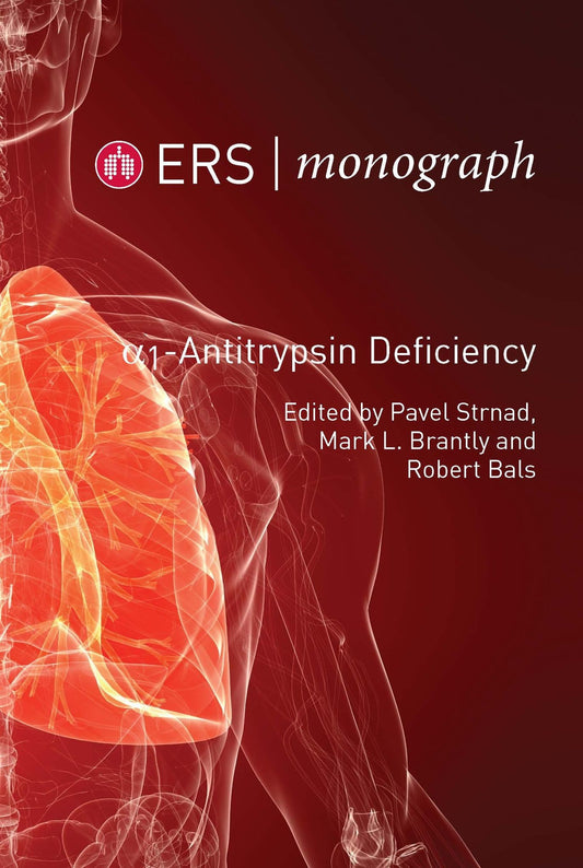 Alpha-1 Antitrypsin Deficiency