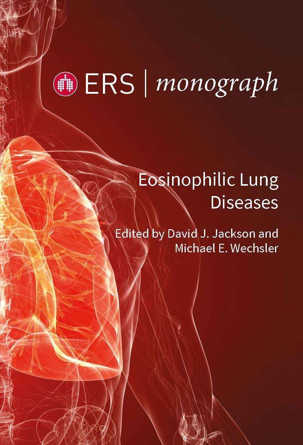 Eosinophilic Lung Diseases