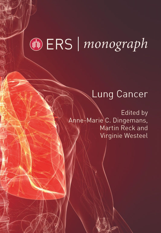 Lung Cancer