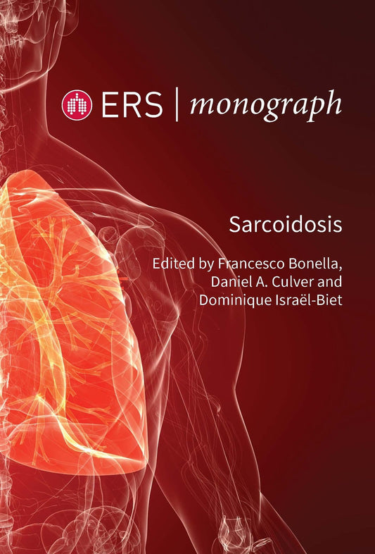 Sarcoidosis