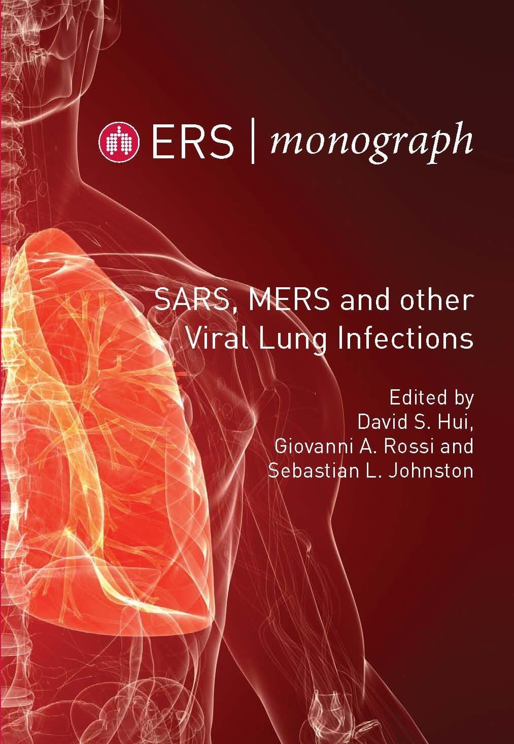 SARS, MERS and other Viral Lung Infections